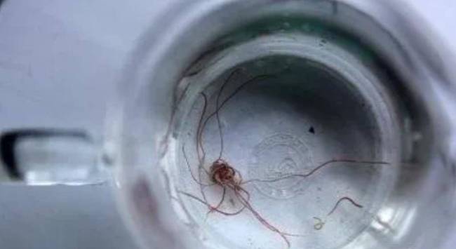 郑州一小区水龙头打开有线虫流出来，二次供水惹的祸 