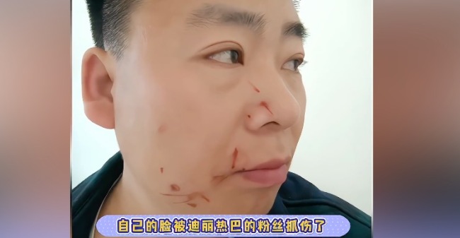 特效师合成热巴视频被打 路人直呼不是粉丝都想打他，这算是性骚扰了吧！