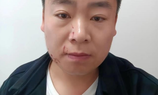 洪亮被迪丽热巴粉丝殴打
