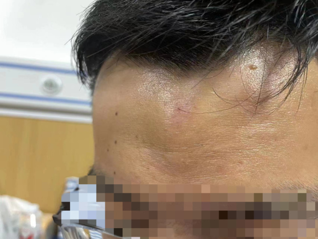 遭殴打记者已辨认嫌疑人 有三人已被当地警方控制