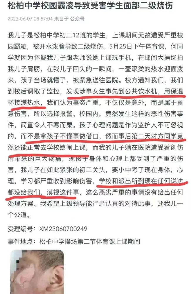 初二女生开水泼男同学脸炫耀：又不能把我怎么样，女生家长：她有抑郁症