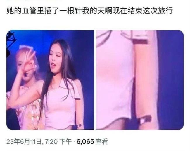 Jennie因身体不适演唱会一半突然退场 目击者称她胳膊上带着留置针
