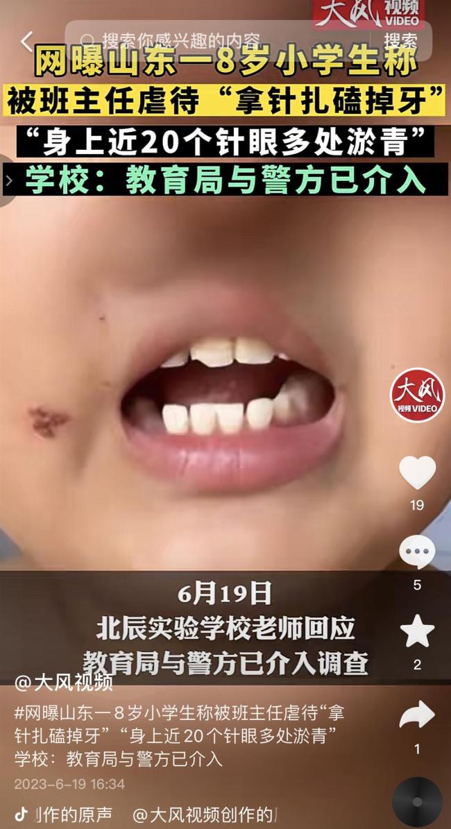 男童被扎.jpg