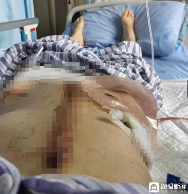 女子2年被家暴16次逃到朋友家又被找到，曾向多部门求助无果！