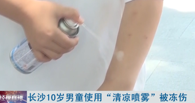 男童使用清凉喷雾被冻伤 网红产品谨慎使用！