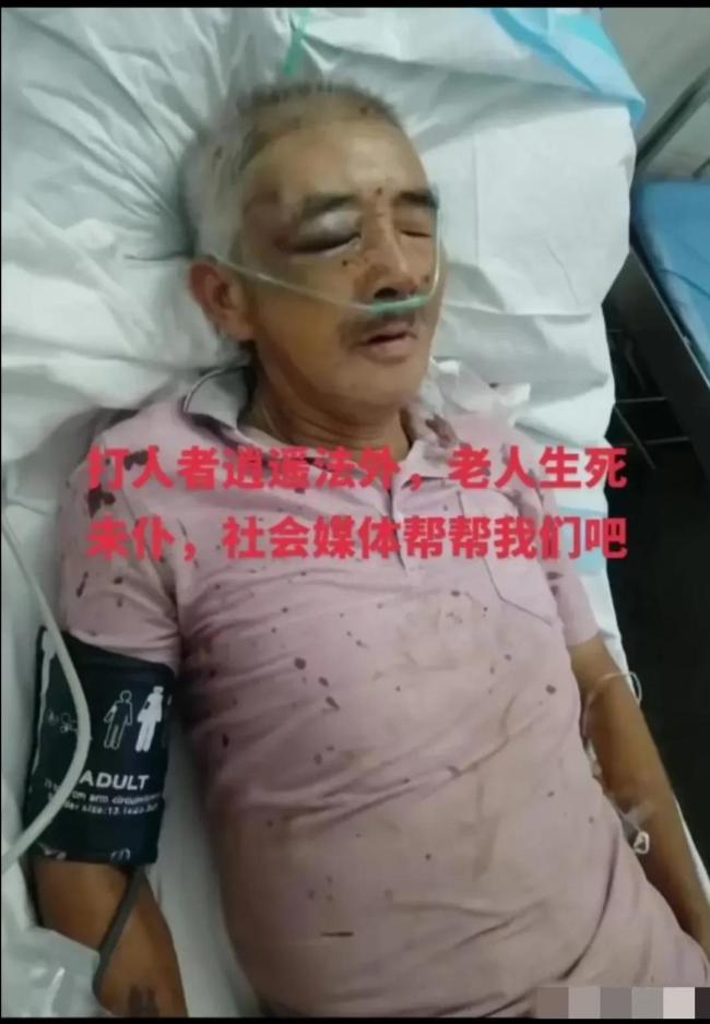 警方回应村霸殴打老人：打人者已被抓 处行政拘留15天处罚