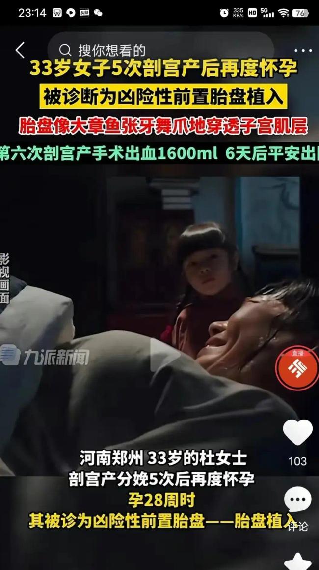 郑州女子6次剖宫产分娩，已经是5个孩子的妈