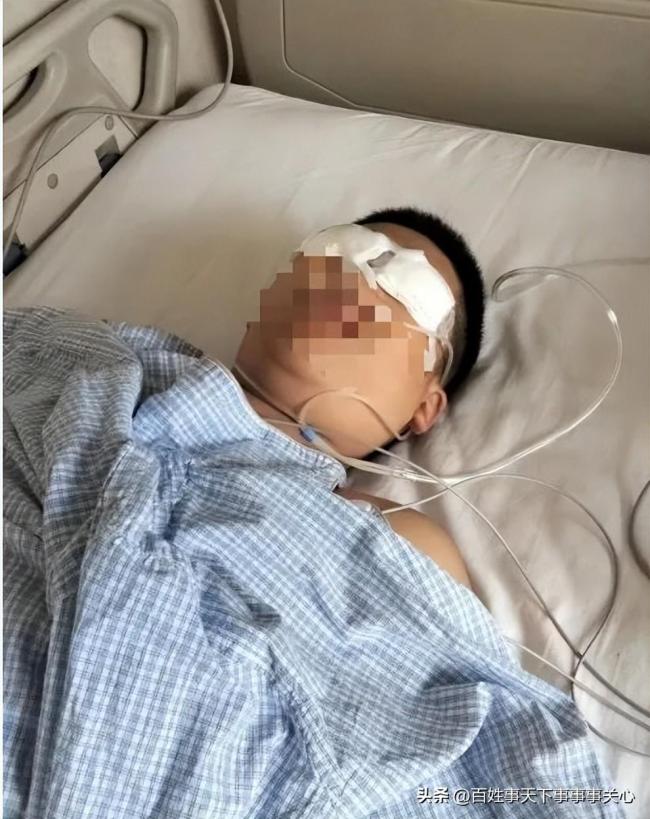 曝河北一13岁男生遭老师殴打致左眼失明：家属索赔300万 公安、教育局已介入调查