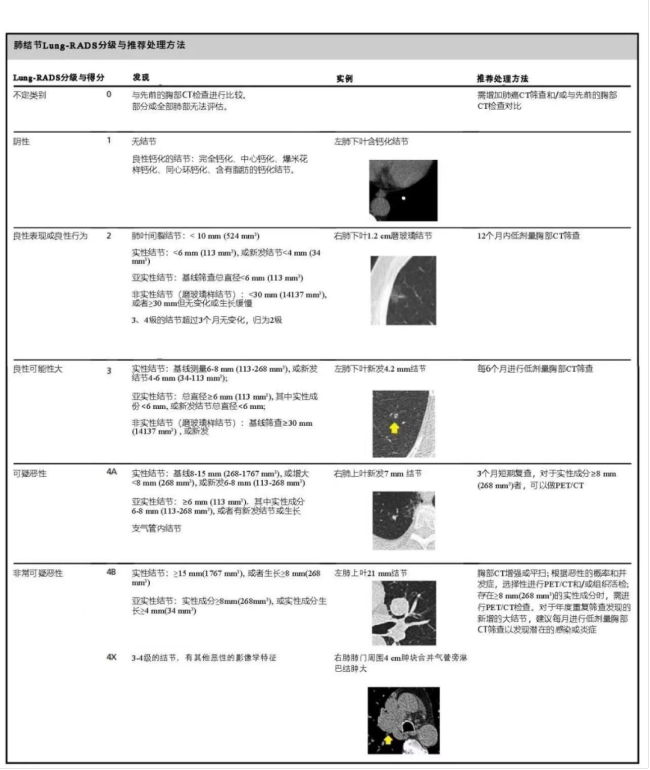 肺癌病理诊断报告单图片