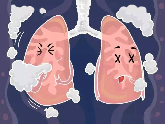 专家谈慢阻肺发展现状 慢阻肺是中国第三大致死性疾病