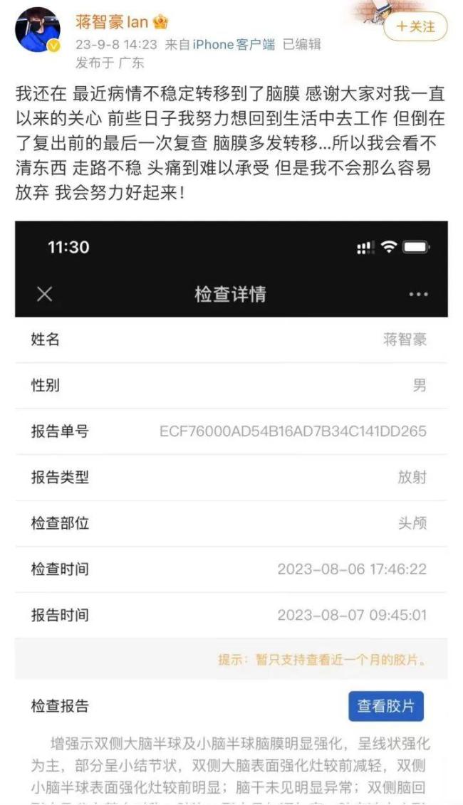 28岁男星回应确诊肺癌晚期：近况不算稳定 但坚持过来了