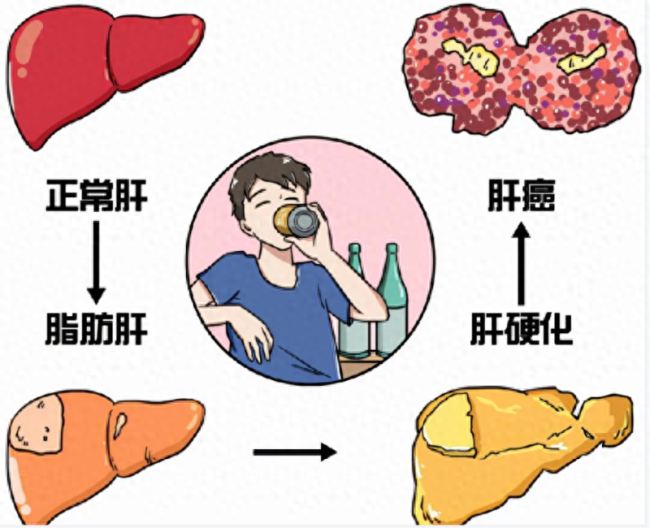 女子半年减重20公斤确诊重度脂肪肝 医生：由于过度节食“饿”出来的