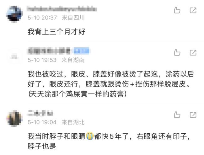 女子遭隐翅虫袭击眼皮腐烂 “会飞的硫酸”将进入活跃期