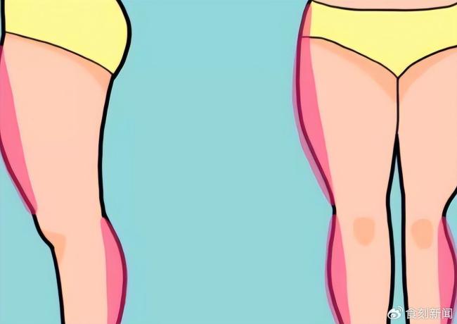 女生不胖但大腿很粗是什么原因？