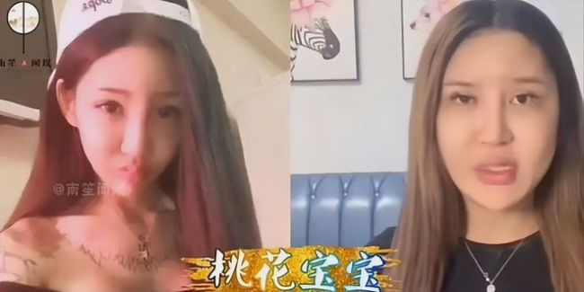 后悔了！女子注射400支玻尿酸丰臀致臀部感染，现在屁股里面全是脓水