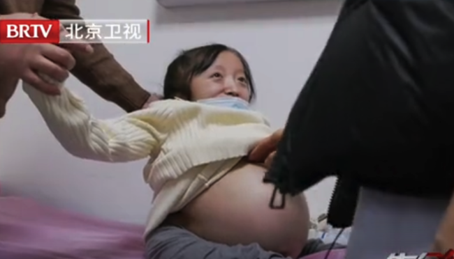 “瓷娃娃”怀孕8个月已不能行走