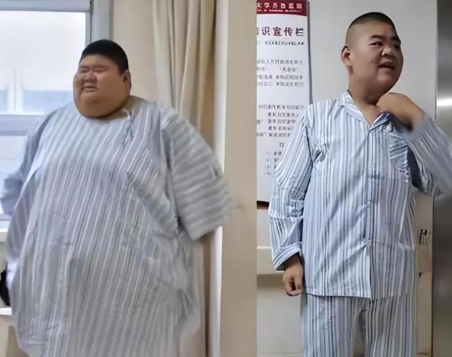 340斤小伙切胃一年后减重200斤 爱情与背叛的故事