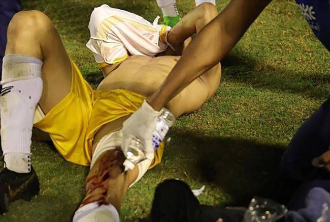 球赛爆发冲突警察开枪打伤门将 暴力阴影笼罩南美足坛