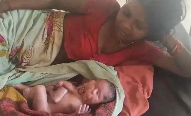 印度女子诞下有2张脸4条胳膊的婴儿 罕见双头连体奇迹