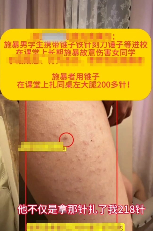 女生被同桌扎数百下 校园安全引担忧