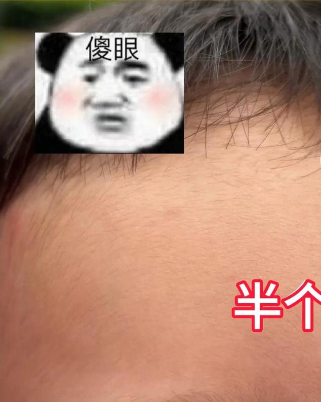 宝妈用狗尾巴草给孩子点痣惊呆网友 传统VS现代的育儿抉择