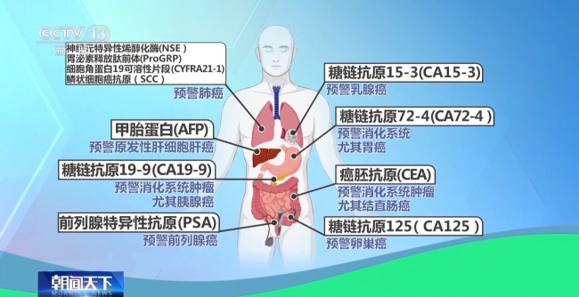 常见指标如何解读？一文看懂体检报告