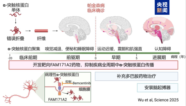 复旦大学科研团队发现帕金森病全新治疗靶点