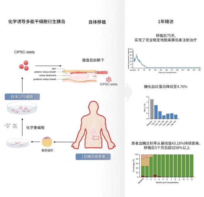 告別胰島素注射,！杭企突破性技術讓糖尿病治愈成為可能