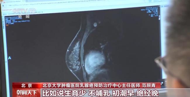 每分鐘全球有4名女性確診這種癌癥……乳腺癌威脅加劇