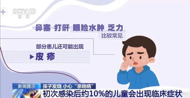 4岁孩子高烧不退，竟然患上“亲吻病”，症状速查