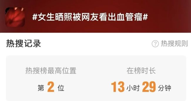 女生晒照被网友看出血管瘤 网友：默默打开手电筒