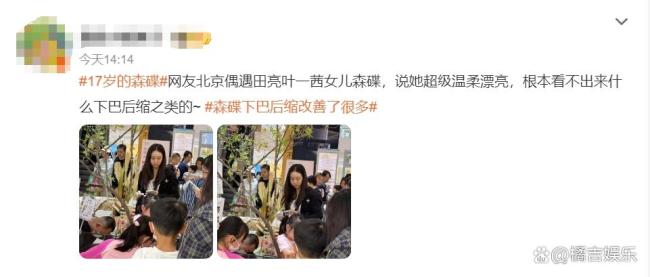 森碟下巴后縮改善了很多 青春魅力綻放