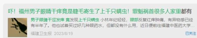 13歲男孩眼癢取出86條螨蟲,，醫(yī)生提醒：吃甜食熬夜眼睛或長螨蟲 不良習(xí)慣助長螨蟲滋生