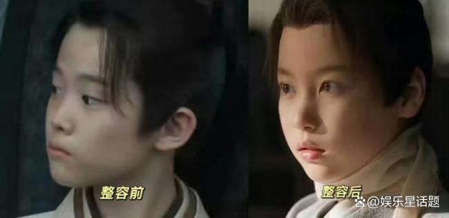 藏海整容的原因