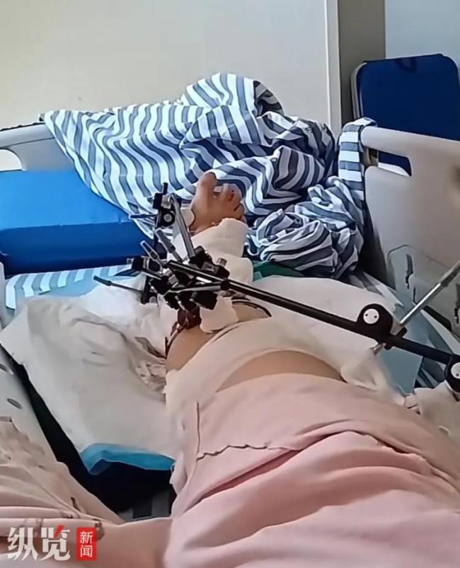 江西一女子從12樓不慎墜落奇跡生還,，當(dāng)事人還原細(xì)節(jié)