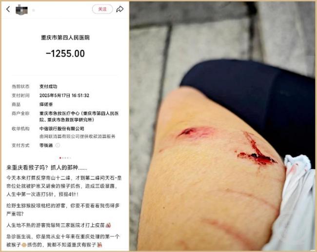 游客在重慶南山被野猴抓傷