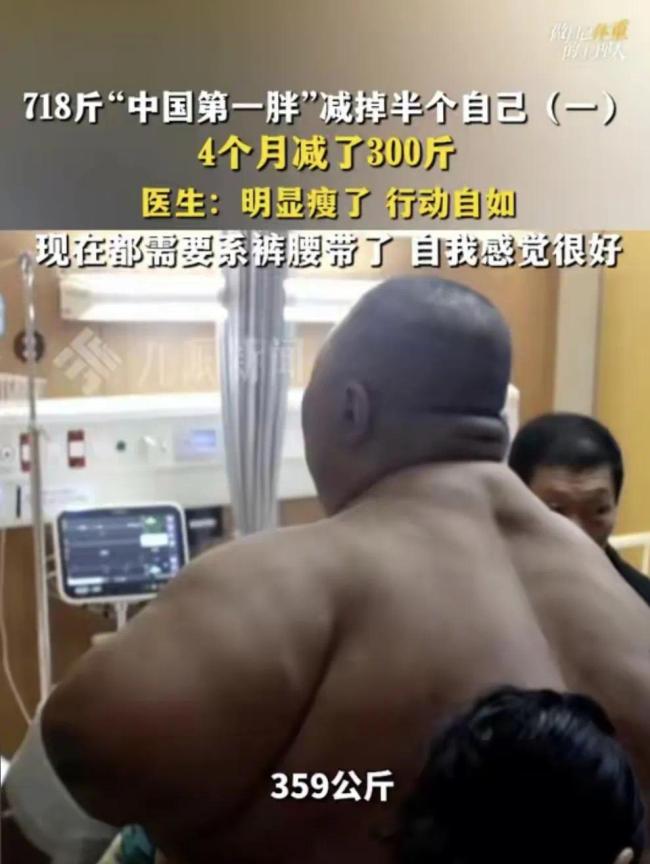 “中國第一胖”切掉70%的胃 體重降至490斤!
