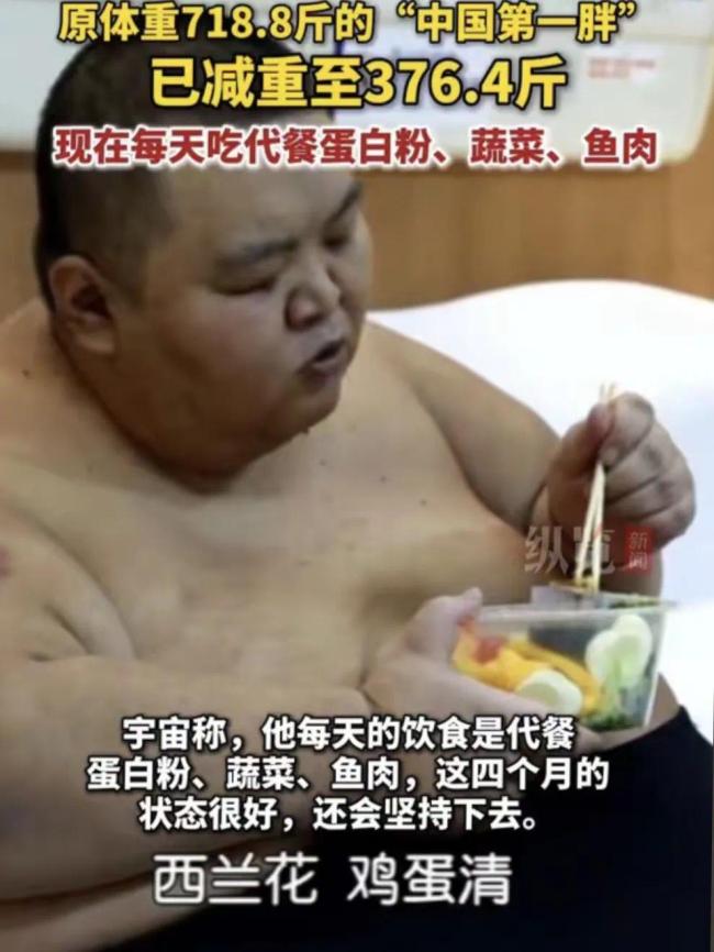 “中國第一胖”切掉70%的胃 體重降至490斤！