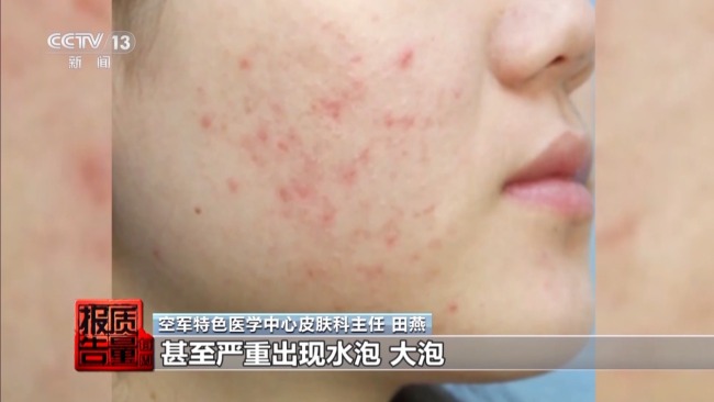 揭开防晒化妆品的“迷雾” “防护”还是“防晒”