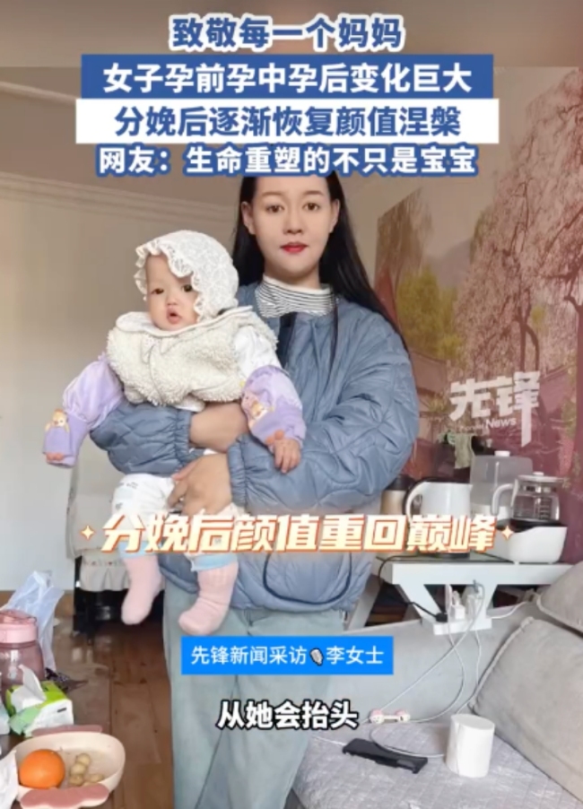 女子分享孕中孕晚分娩后容貌變化 孕激素下的變形記