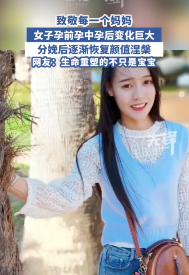 女子分享孕中孕晚分娩后容貌變化 孕激素下的變形記