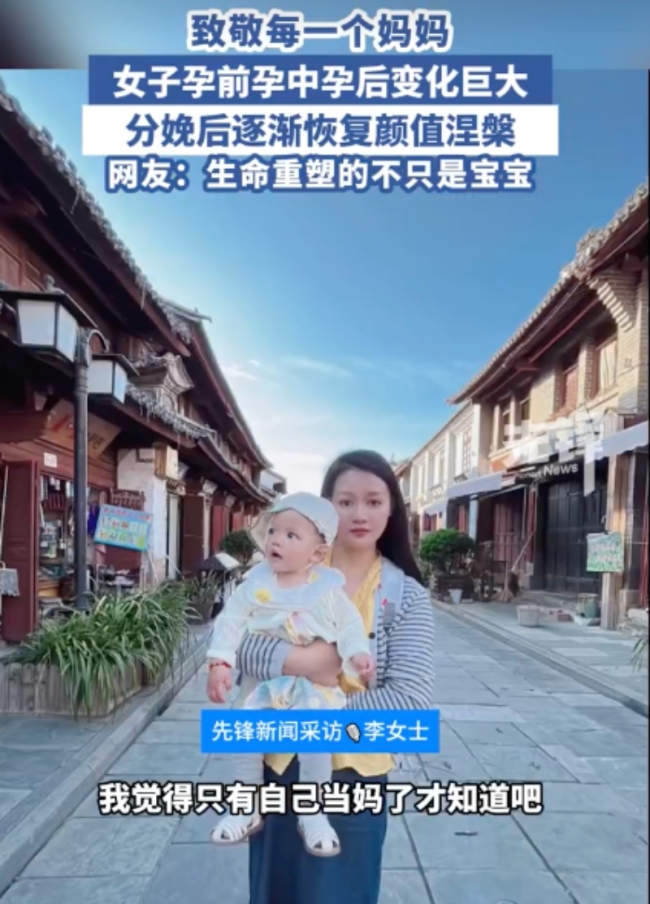 女子分享孕期分娩后容貌變化 孕激素下的變形記