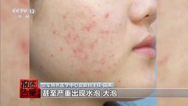 隔離防護(hù)產(chǎn)品防曬有效果嗎