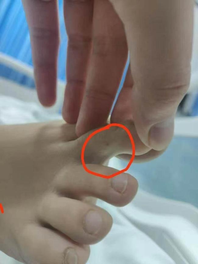 博主推測(cè)三亞女子或被銀環(huán)蛇咬傷 家屬質(zhì)疑醫(yī)院救治不當(dāng)