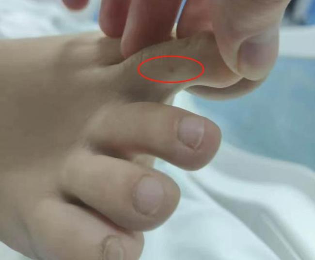 博主推測(cè)三亞游客或被銀環(huán)蛇咬傷 事件引發(fā)廣泛關(guān)注