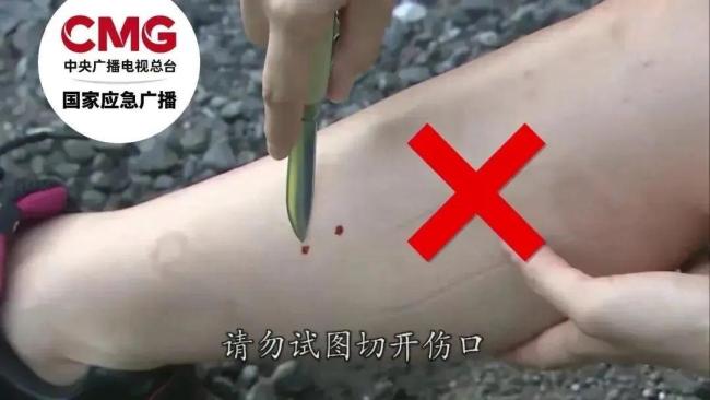 專家提醒被蛇咬后這九大土方法危險(xiǎn) 誤區(qū)需警惕