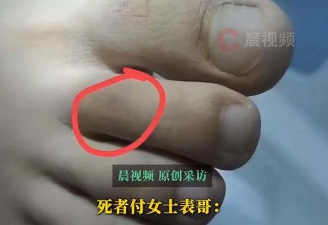 女子臨床死亡后父親要求繼續(xù)搶救 家屬質(zhì)疑醫(yī)院失職