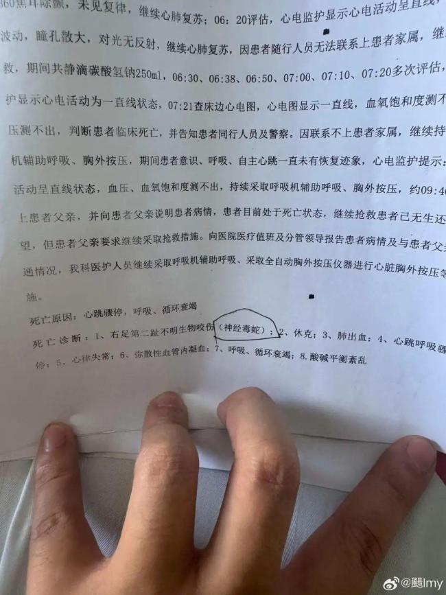 被咬身亡女子确认为毒蛇咬伤 家属辟谣捐款传闻 ，小米汽车登记机盖作品著作 铭牌设