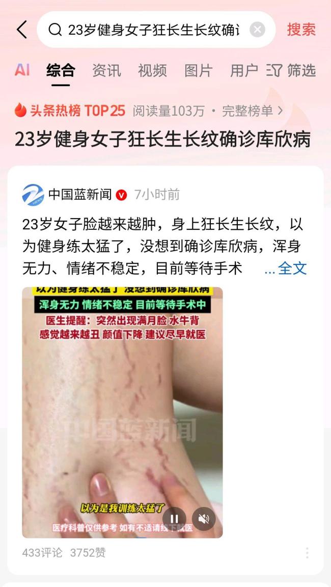 23岁女健身教练身上紫纹越长越多 罕见库欣病确诊