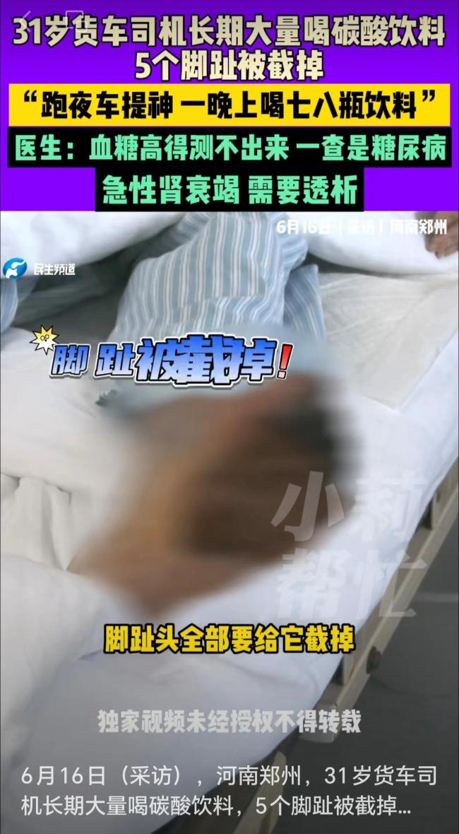 31歲貨車司機(jī)長期大量喝碳酸飲料，5個腳趾被截掉